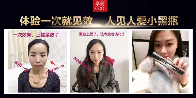 郑州美博会_因V不凡，小黑瓶的魅力无法阻挡。